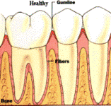 Healthy+gums+color